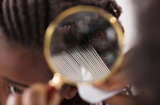 Come eliminare i pidocchi dai capelli molto ricci e afro: i rimedi naturali