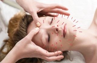 Che cos’è l’agopuntura cosmetica e perché dovresti provarla