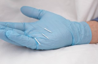 Che cos'è la dry needling, l’alternativa all’agopuntura