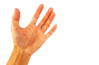 Come togliere il silicone dalle mani: 3 rimedi facili