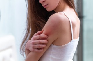 Eczema, 6 cose che non dovresti mai fare