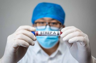 Cos'è l'infezione da streptococco e come si manifesta