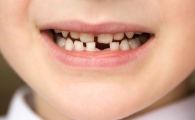 denti dei bambini