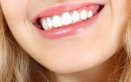 denti, sorriso, bocca, denti, dentatura, dentista, morso, mordere, dentiera