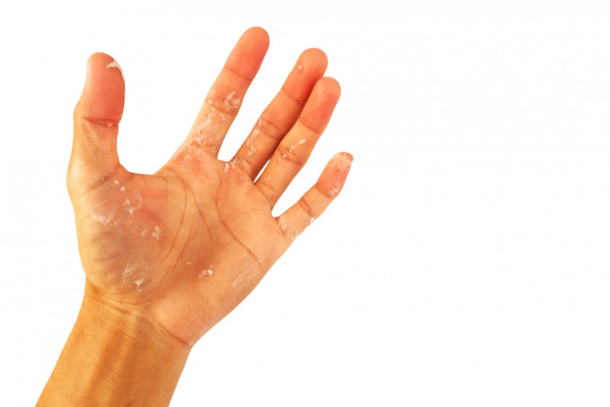 come togliere silicone mani, come pulire silicone mani, togliere silicone pelle